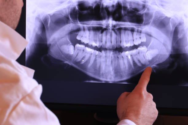 Best Knocked-Out Tooth Emergency  in Basye, VA